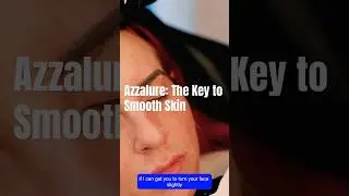 Azzalure: The Key to Smooth Skin ✨ | Aesthetic Practitioner&rsquo;s Guide