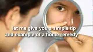 The Remedy Of Acne