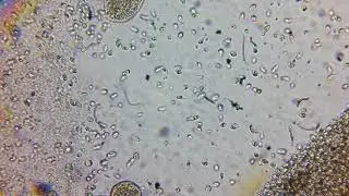 Hexamita  discus disease