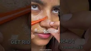 Get Rid of Blackheads and Sebum Instantly! @aprilskin8239#skincare #kbeauty #skincareroutine#fyp