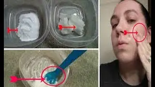 Wash Your Face with Coconut Oil and Baking Soda 3 times a Week, and This Will Happen in a Month