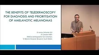The benefits of teledermoscopy for diagnosis and prioritisation of amelanotic melanomas