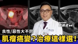子宮肌瘤恐癌變？子宮內膜癌、子宮頸癌治療方式怎麼選？∣ft.劉錦成醫師∣童綜合醫院 婦產科