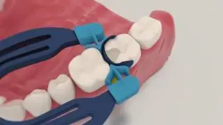 myClip 2.0 - Polydentia