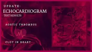 Echocardiogram Results for Blood Clot in my Heart Right Atrial Thrombus MPN Polycythemia Vera BCAM