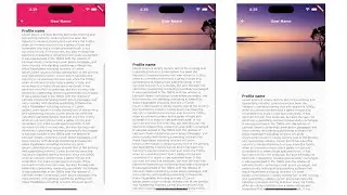 🔴 Flutter create custom scroll view animation An Image Into an App Bar