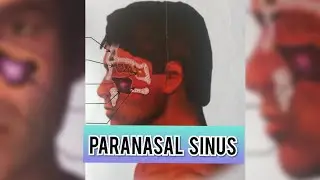 PARANASAL SINUSES || CLINICAL ANATOMY || SINUSITIS || MAXILLARY , FRONTAL , ETHAMOIDAL , SPHENOIDAL