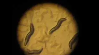 dpy-5 C. elegans