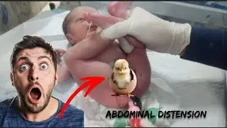 How to Relieve Abdominal Distention in Newborn | Suppository for Constipation #baby #hospital 