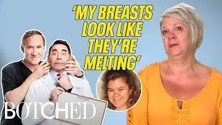 Annie's Breasts Look Like They're MELTING?! | Botched | E!