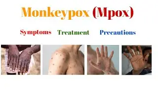 Monkeypox (Mpox) | Symptoms, Treatment Precautions | TV Intellect