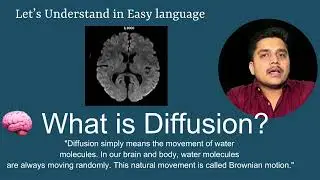 DWI MRI Explained | Stroke Diagnosis & Brain Imaging | हिंदी + English