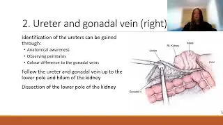 Laparoscopic radical nephrectomy  Sarah Lister