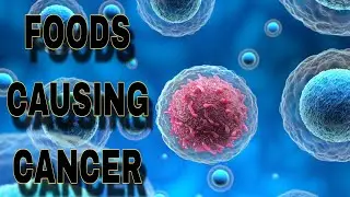 Foods that can cause CANCER. #foreducationalpurposes #cancerprevention #preventcancer #followformore