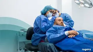 Implante Capilar: Qu&eacute; es, c&oacute;mo se realiza y resultados naturales