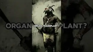 Organ Transplantation in Ancient India? 😱🤯