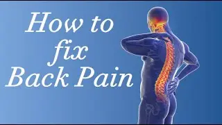 How to Fix back pain with Lumbar Epidural