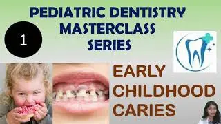 PD 1 Why Kids Get Cavities: Early Childhood Caries (ECC) Fully Explained! #AFK #INBDE #ADC #LDC #ORE
