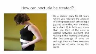 Nocturia (Getting up at night to pass urine)