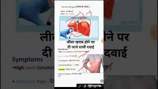 लीवर खराब होने पर दी जाने वाली दवाई#minivlog 61 #emergencydrugs  #shorts#youtubeshorts