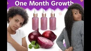Onion Juice For Hair Growth - BEFORE AND AFTER RESULTS