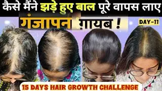 ✨Stop Hair Thinning, Male Or Female Pattern Hair Loss ,Ganjapan👍15 Days Growth Challenge #haircare