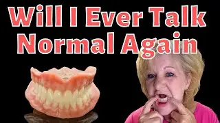 Immediate Dentures & Full Mouth Extraction Is HARD / Talking With Dentures