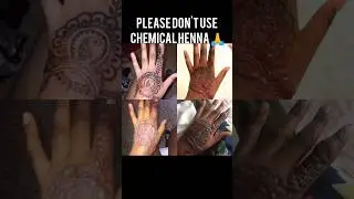 Chemical mehandi reaction Use organic home made henna #shortyoutube #trendingshorts #viral #shorts