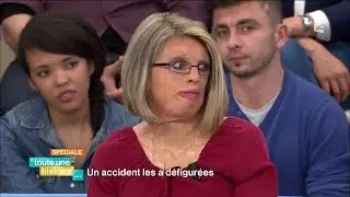 Toute une histoire : Un accident les a défigurées - REPLAY