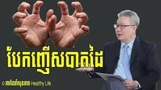 វេជ្ជបណ្ឌិត គួច ម៉េងលី មូលហេតុនៃការ 