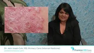 Plaque Psoriasis, What You Should Know - Premier MD Care, Fort Myers, FL