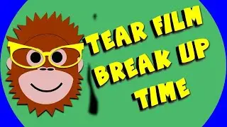 Tear film break up time (BUT) | Gama Eye Care EN