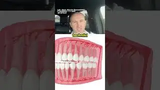 Czy Usuwanie &Oacute;semek Boli 😳😱 (Animacja 3D Dentystyczna)