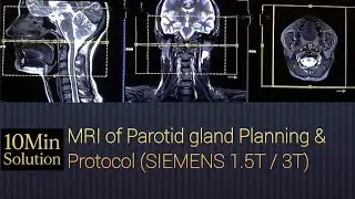 MRI of Parotid Gland | Complete Planning & Protocol Guide (1.5T/3T)