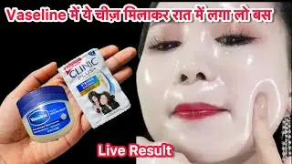 इस तरह से अपने चेहरे पे वैसलीन लगाये और आपका चेहरा इतना गोरा हो जाएगा की हर कोई देखेगा 