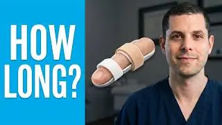 How long should you splint your finger?