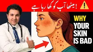 Too Much Sugar Ruins Your Skin! Acne, Dark Spots & Dullness Explained