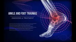 🦶 Structure of the Foot Explained by an MD Doctor! | Anatomy, Functions & Common Injuries