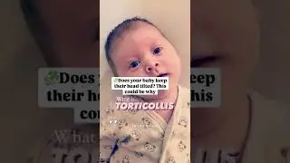 🧩DOES YOUR BABY KEEP THEIR HEAD TILTED? THIS COULD BE WHY #pediatrician #baby #torticollis #flathead
