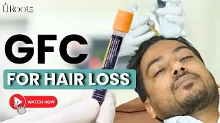 GFC For Hairloss | GFC Hair Treatment | GFC Procedure & Benefits of GFC | Hair Fall Treatment #qht
