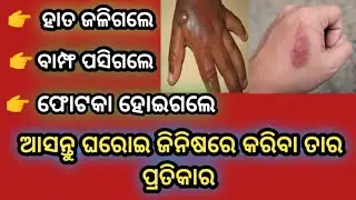How To Cure Burnt Skin At Home |Odia Tips |
