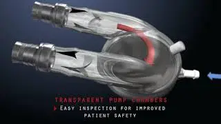Berlin Heart EXCOR Animation