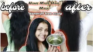 ✨Homemade Hair Mask ✨गंजे सर पर भी बाल उगेगी ये हेयर मास्क से  @SaiSushamaPatel
