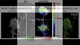 Activation of ADF(cofilin) mediates attractive growth cone guidance.mov
