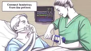 Spacelabs Early Ambulation with Wireless ECG