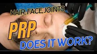 Unlock the Power of PRP Injections: Hair Growth, Facial Rejuvenation, and Joint Healing Explained