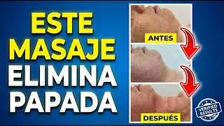 Elimina la papada con este masaje/resultado garantizado