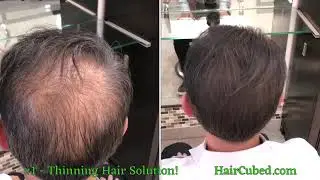 Nanogen fibers vs. Hair3 fibers