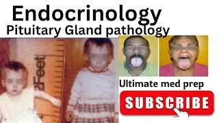 Pituitary Gland pathology | Hyperpituitarism |Hypopituitarism #medicalstudies #usmle