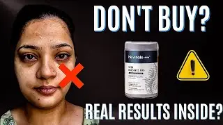 Do NOT buy HK Vitals Skin Radiance Pro before watching this video! ⚠️